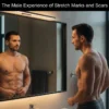 The-Male-Experience-of-Stretch-Marks-and-Scars